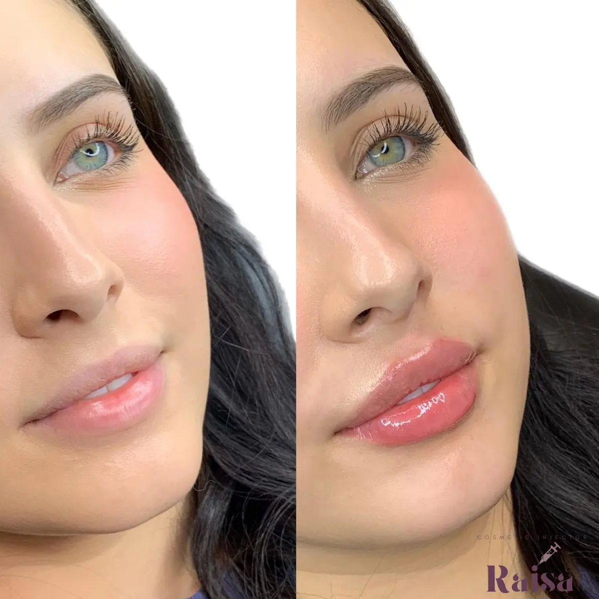 ژل لب طبیعی ساده